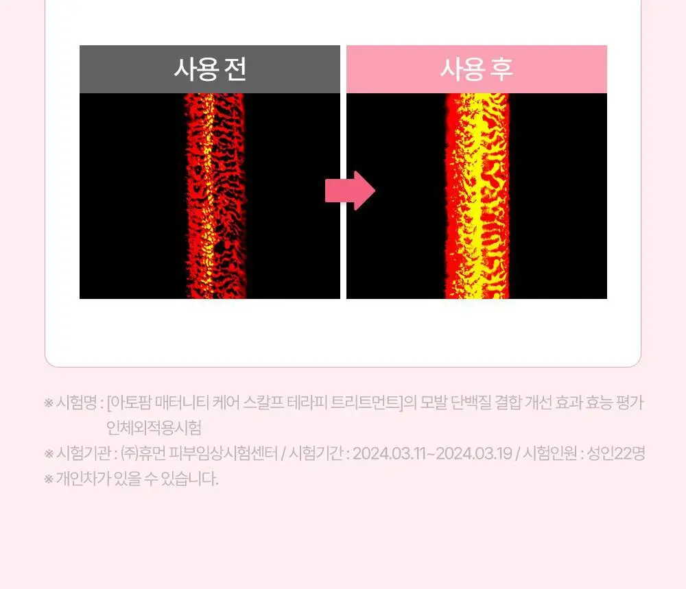 [임산부] 아토팜 매터니티 케어 스칼프 테라피 트리트먼트 220ml 상세페이지 19